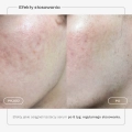 serum-przebarwienia-karta-produktu-6.webp