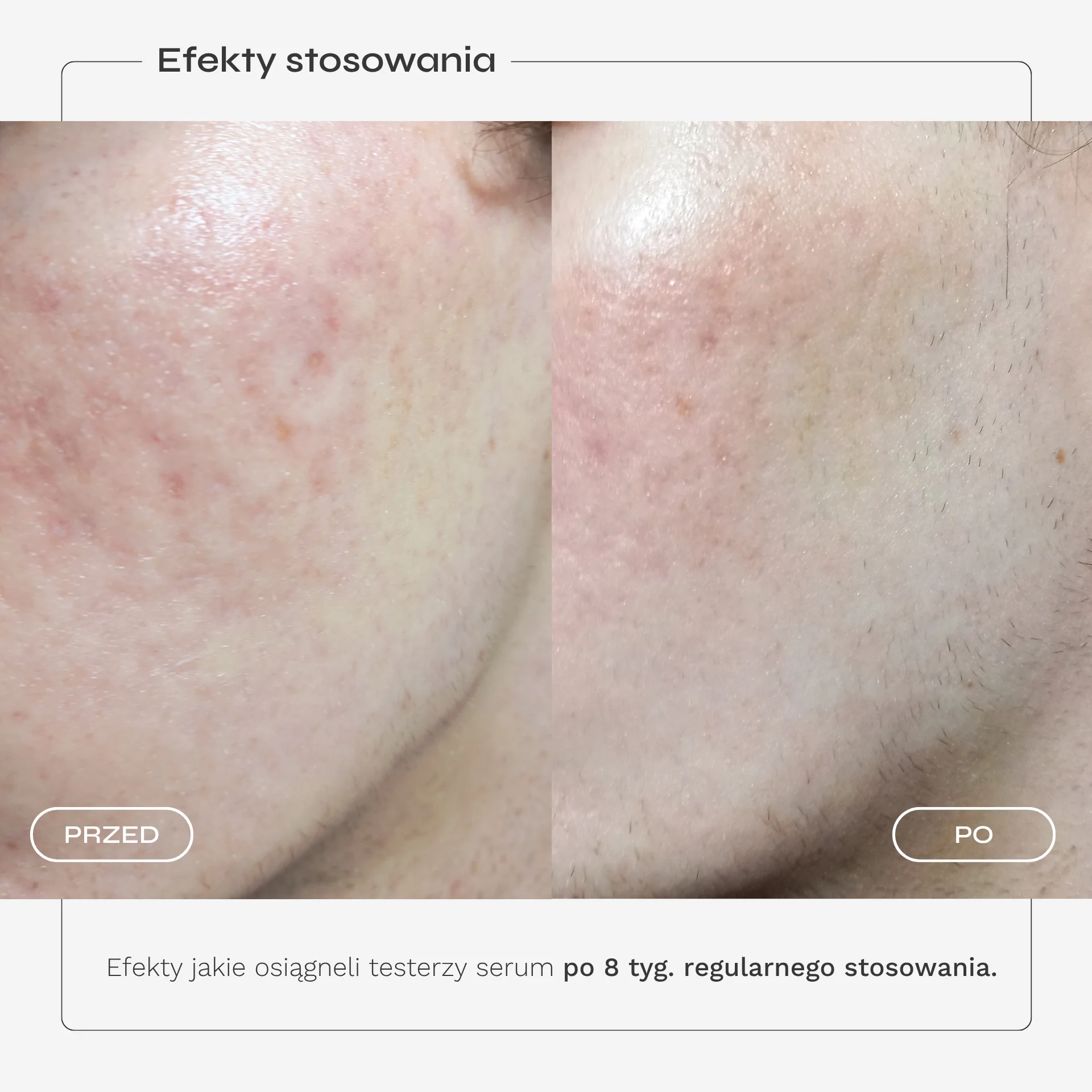 serum-przebarwienia-karta-produktu-6.webp