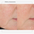 serum-retinol-karta-produktu-06.webp