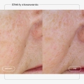 serum-retinol-karta-produktu-07.webp