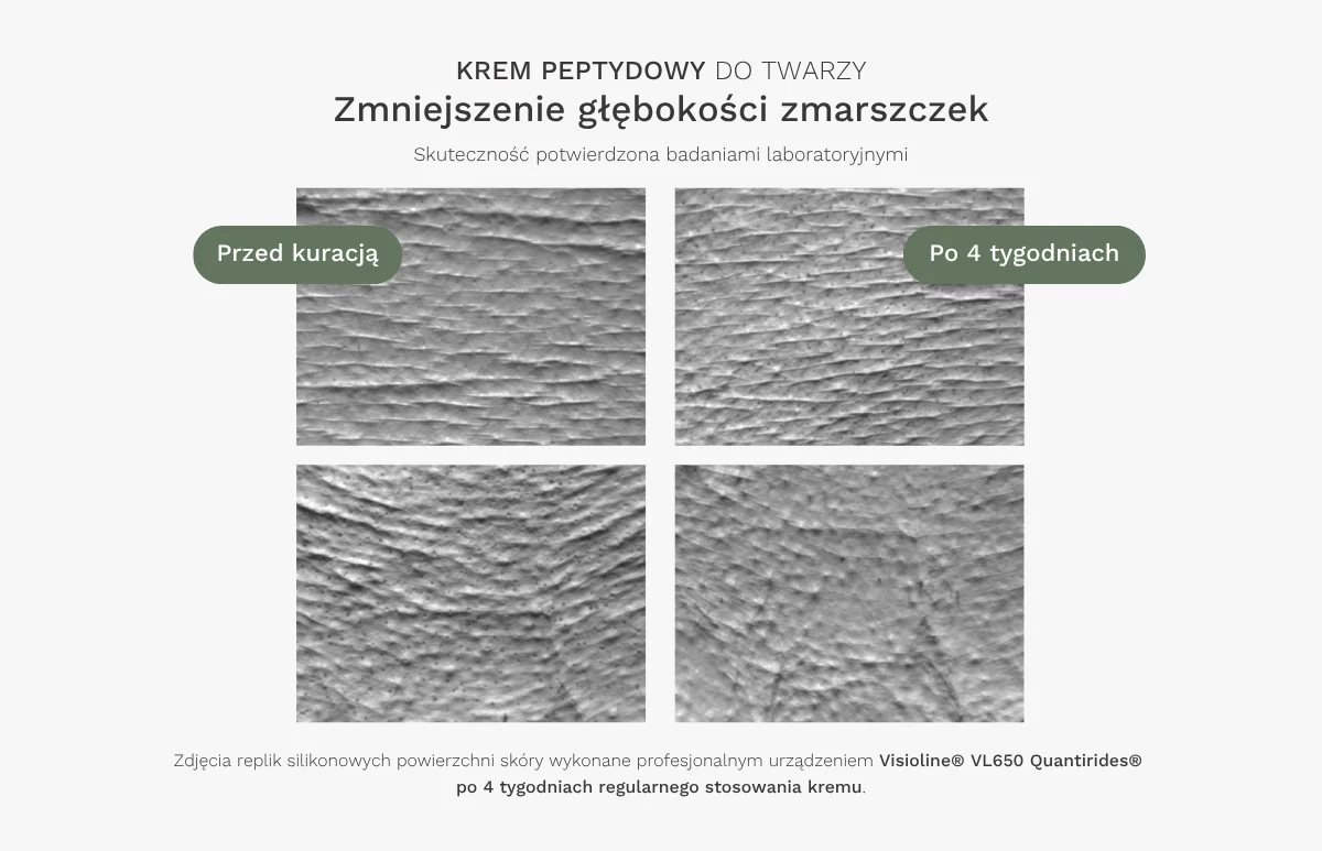 Badania aparaturowe krem peptydowy