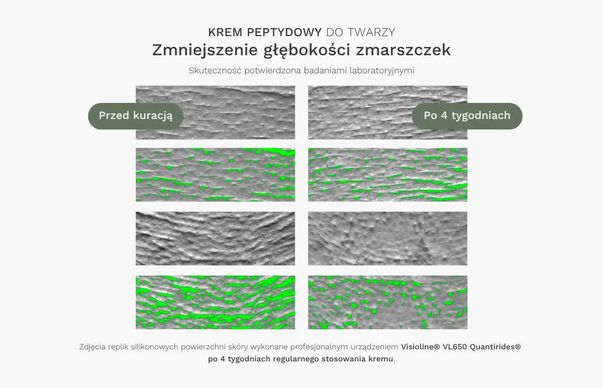 Badania aparaturowe krem peptydowy 2